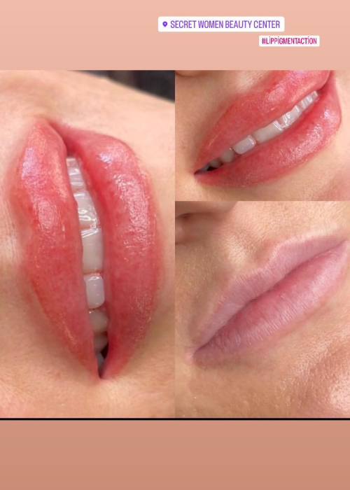 مرکز زیبایی سکرت / تکسیم / سالن اپیلاسیون، سالن مراقبت از پوست